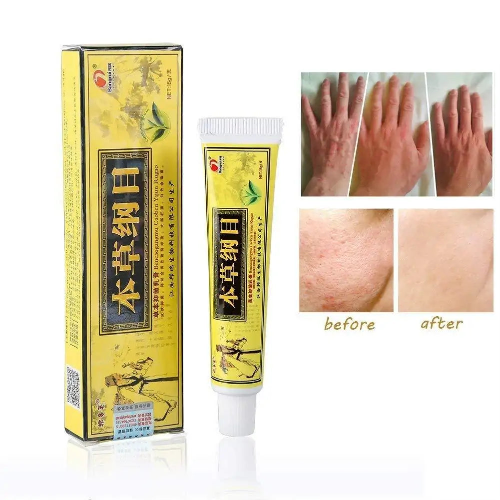 Eczema Natural Herbal Cream - Addy Mart