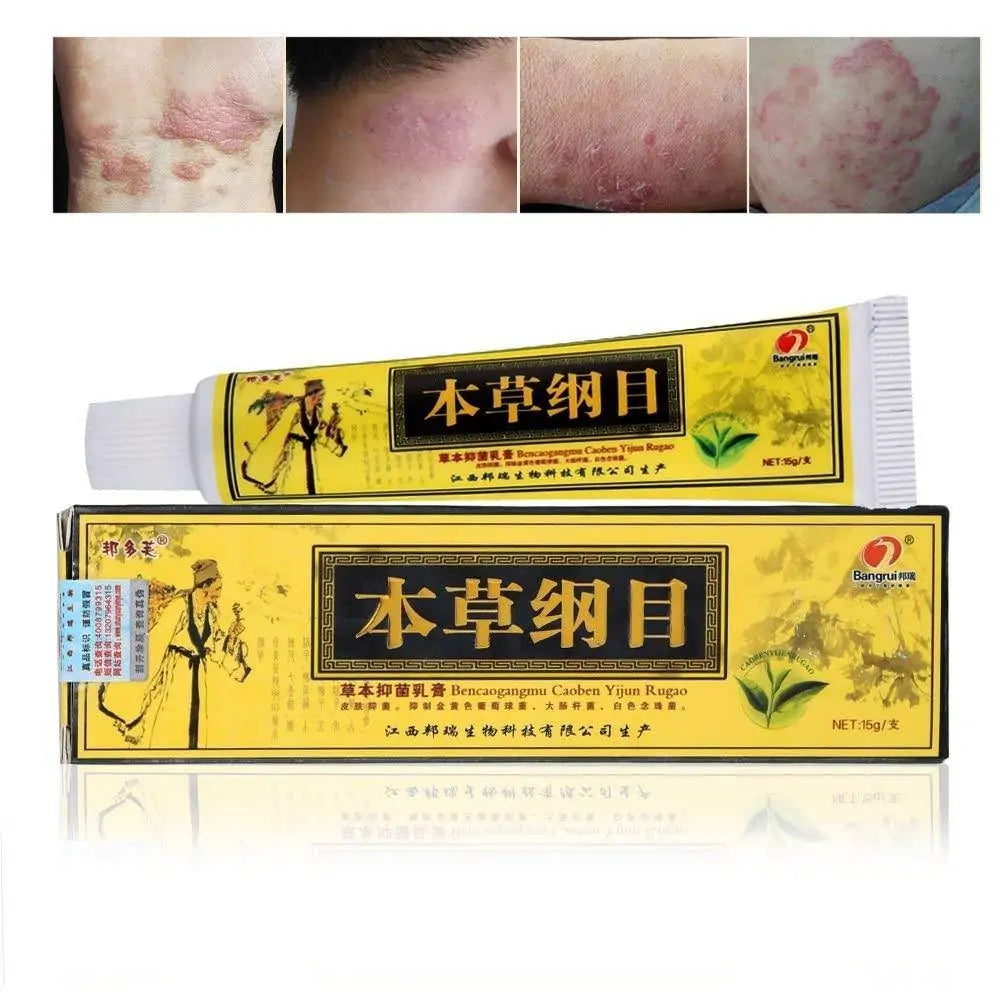 Eczema Natural Herbal Cream - Addy Mart