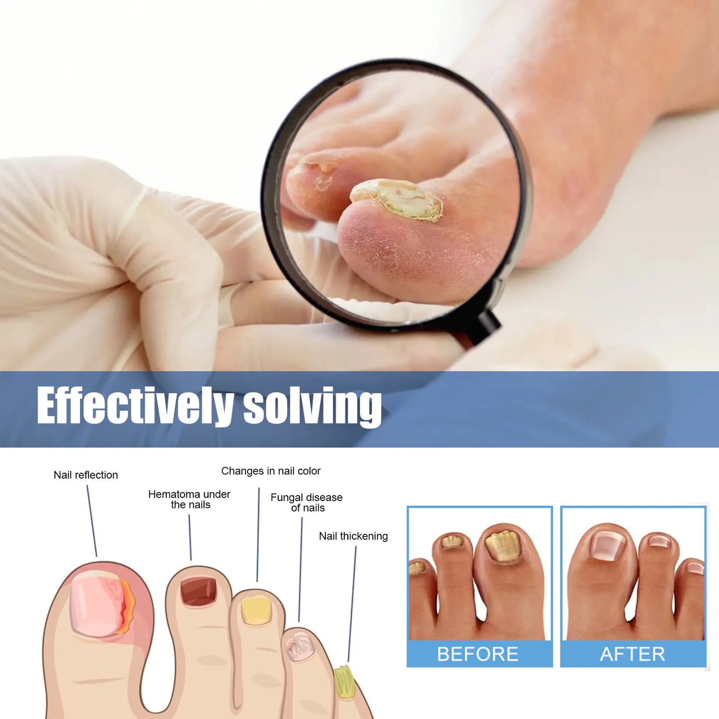 Nail Repair Bandage - Addy Mart