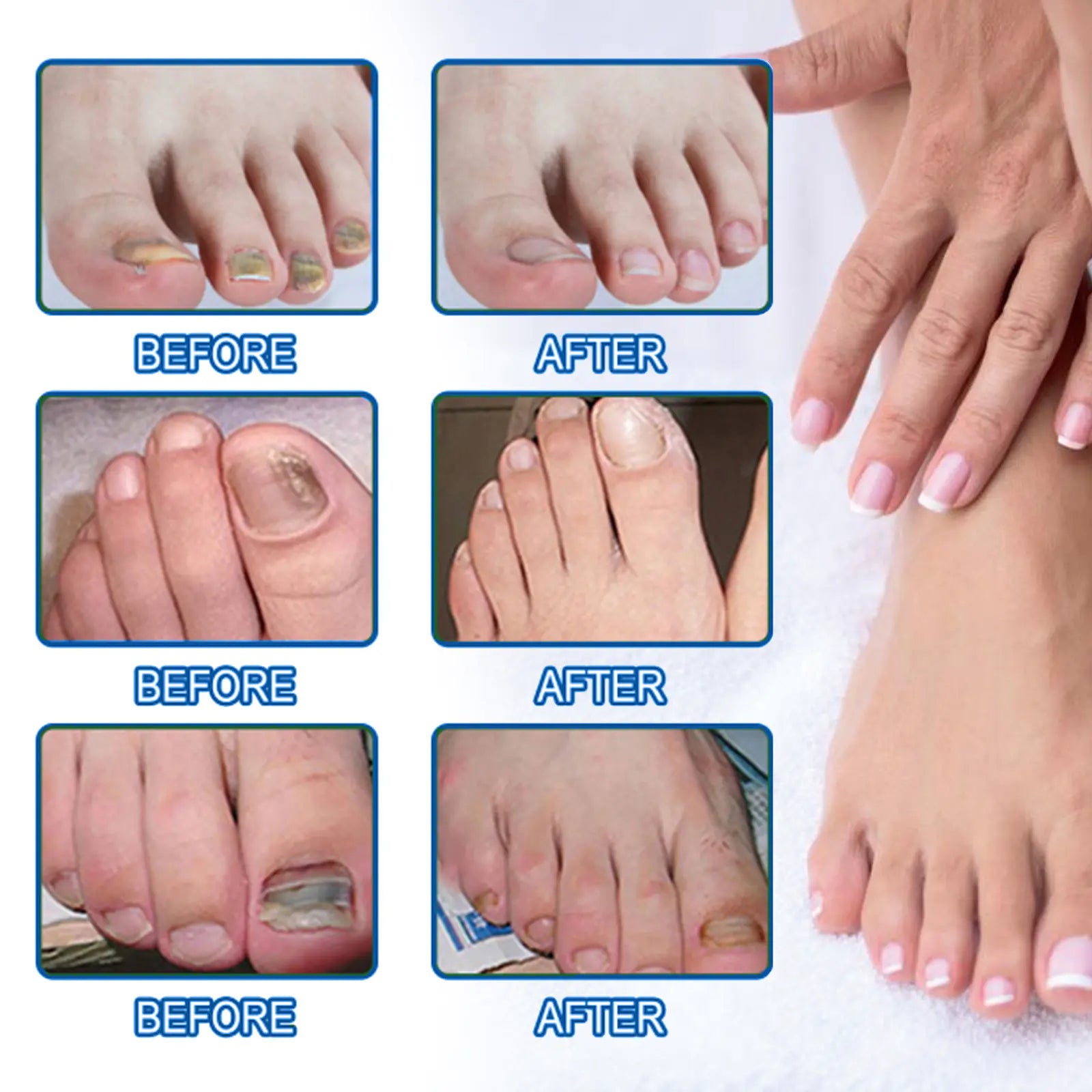 Nail Repair Bandage - Addy Mart