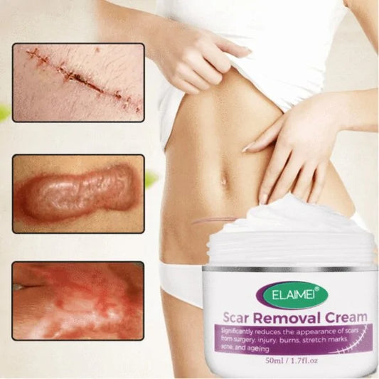Scar Removal Cream - Addy Mart