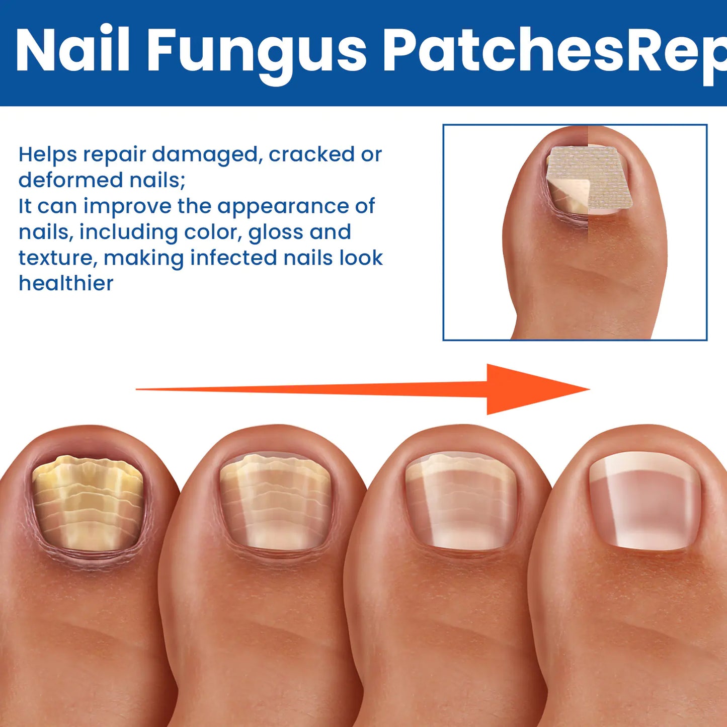 Nail Repair Bandage - Addy Mart